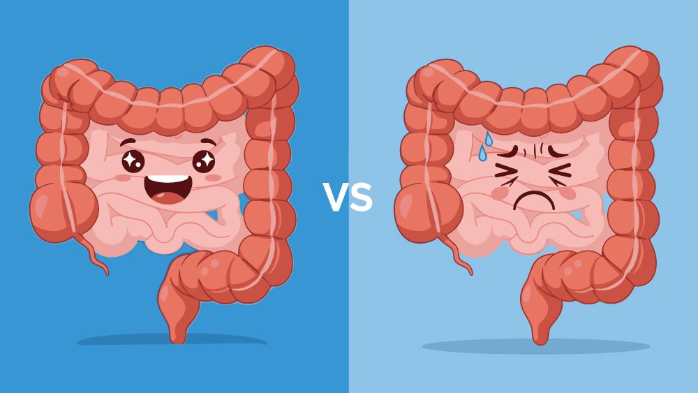 Cuando la fibra no basta para el tránsito intestinal