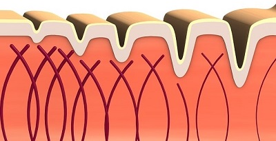 Pieles mixtas a grasas
